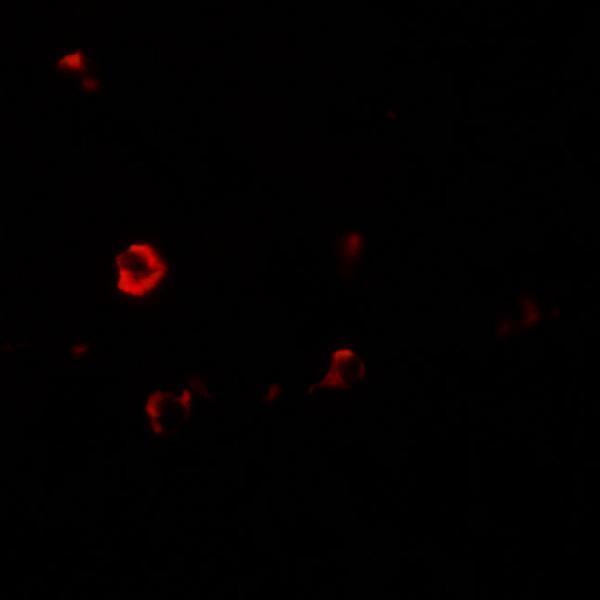 Immunofluorescence of IL-1RL2 in human small intestine tissue with IL-1RL2 antibody at 20 μg/mL