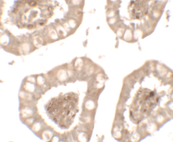 Immunohistochemistry of IL-1RL2 in human small intestine tissue with IL-1RL2 antibody at 5 μg/mL