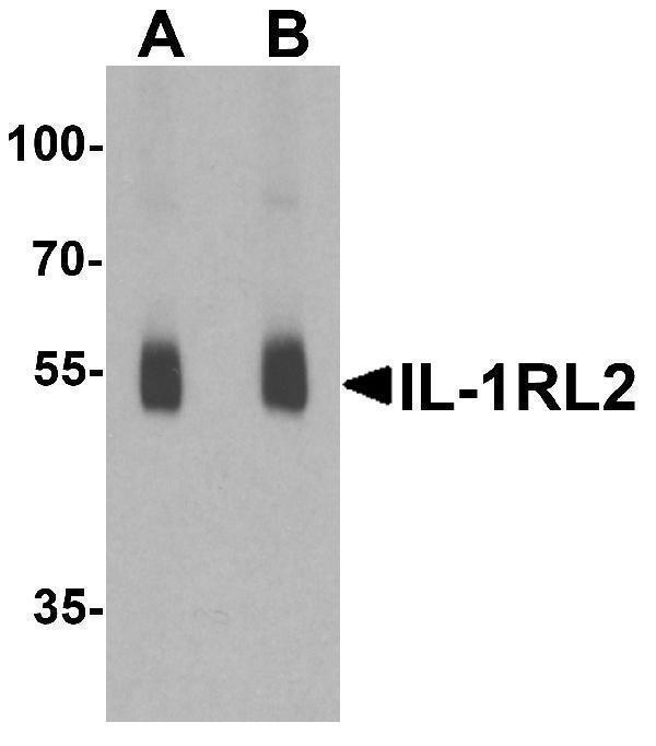 Western blot analysis of IL-1RL2 in human small intestine lysate with IL-1RL2 antibody at (A) 1 and (B) 2 μg/ml