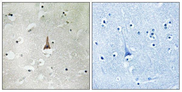 Immunohistochemistry analysis of paraffin-embedded human brain tissue, using LRP10 Antibody