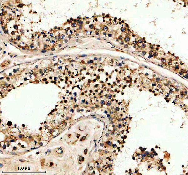 a09206 1 ift81 primary antibodies ihc testing 1