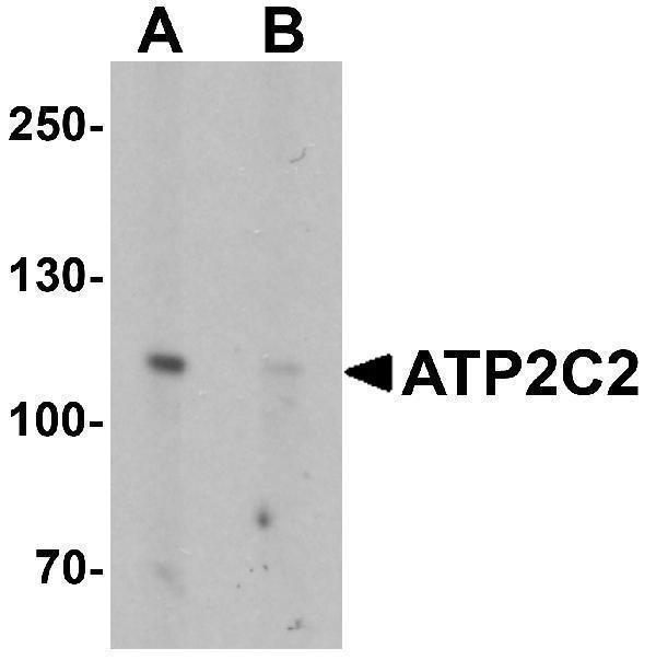 a09207 atp2c2 primary antibodies wb testing 1