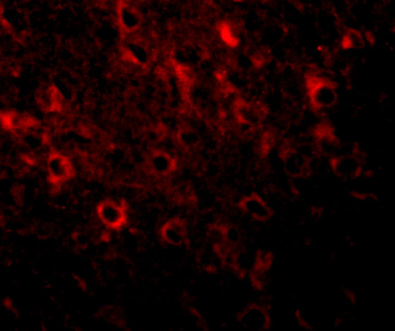 a09208 fam120a primary antibodies if testing 3