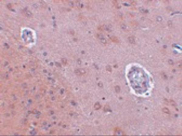 a09208 fam120a primary antibodies ihc testing 2