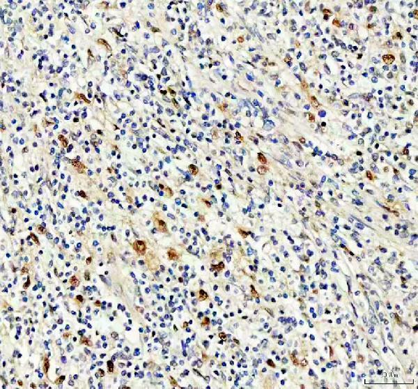 IHC analysis of NKX2-3 using anti-NKX2-3 antibody (A09210-1)