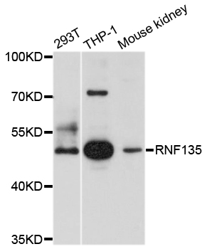 a09212 rnf135 primary antiboties wb testing 1