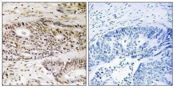 Immunohistochemistry analysis of paraffin-embedded human colon carcinoma tissue, using USP48 Antibody