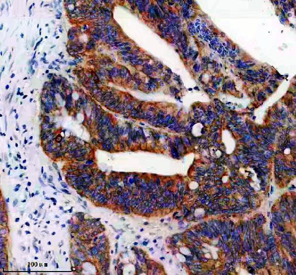 a09218 1 timm23 primary antibodies ihc testing 1