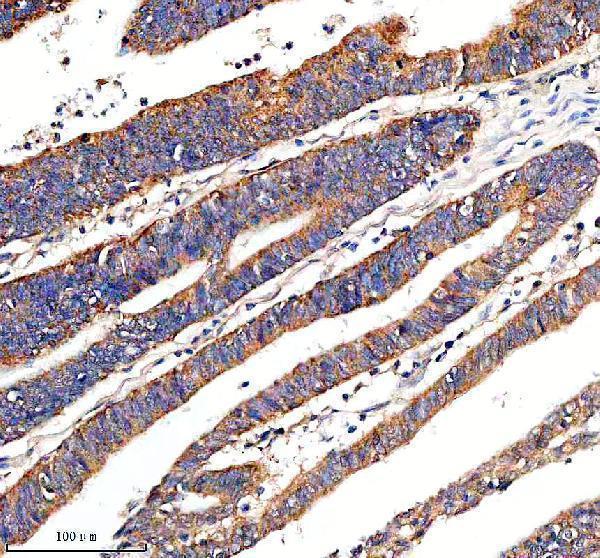  IHC analysis of TIMM23 using anti-TIMM23 antibody (A09218-1)