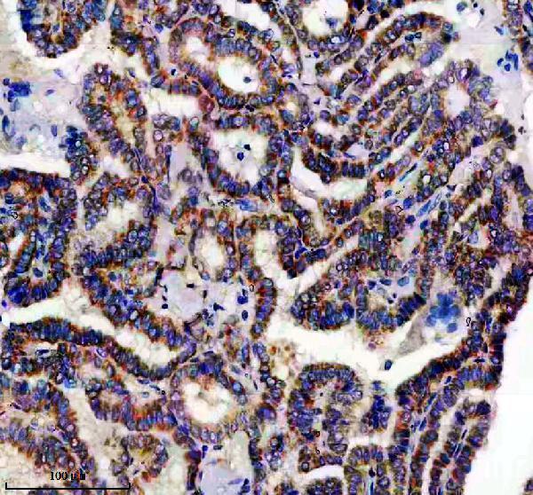a09218 1 timm23 primary antibodies ihc testing 2_1