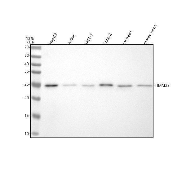  Western blot analysis of TIMM23 using anti-TIMM23 antibody (A09218-1)