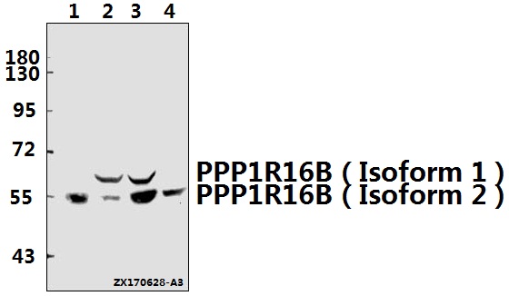 a09221 1 ppp1r16b primary antiboties wb testing 1