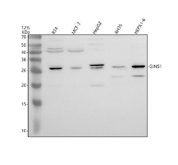 Western blot analysis of GINS1 using anti-GINS1 antibody (A09225-1)