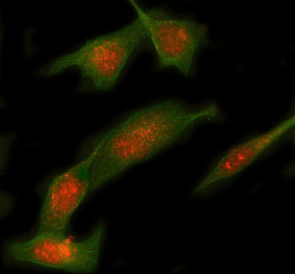  IF analysis of Syntaxin 12/STX12 using anti-Syntaxin 12/STX12 antibody (A09232-1) and anti-Beta Tubulin antibody (M01857-3)