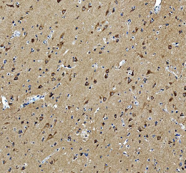 IHC analysis of Syntaxin 12/STX12 using anti-Syntaxin 12/STX12 antibody (A09232-1)