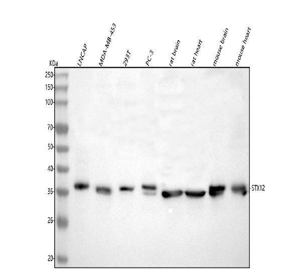  Western blot analysis of Syntaxin 12/STX12 using anti-Syntaxin 12/STX12 antibody (A09232-1)