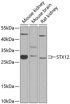 a09232 stx12 primary antiboties wb testing 1