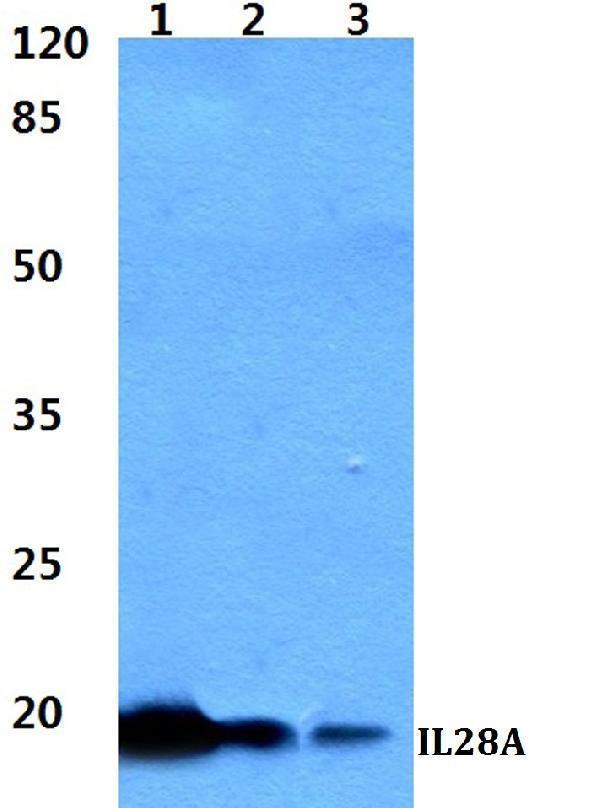 Western blot (WB) analysis of IL28A polyclonal antibody at 1:500 dilution
Lane1:HEK293T cell lysate
Lane2:Raw264