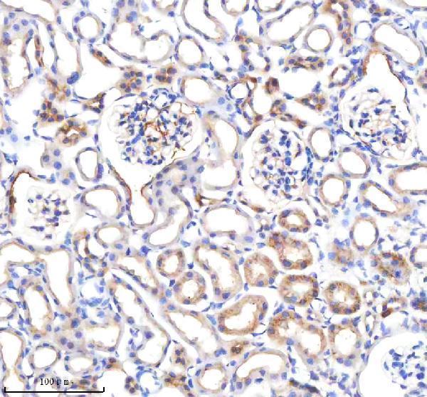  IHC analysis of P3H2 using anti-P3H2 antibody (A09235-1)