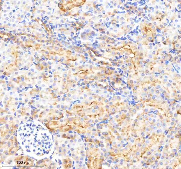  IHC analysis of P3H2 using anti-P3H2 antibody (A09235-1)