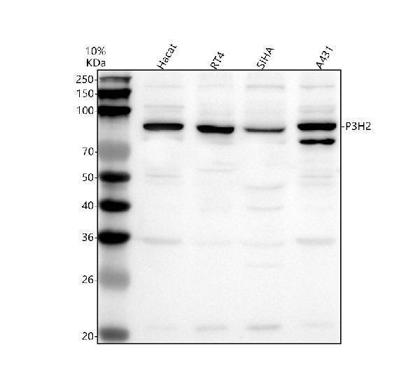  Western blot analysis of P3H2 using anti-P3H2 antibody (A09235-1)