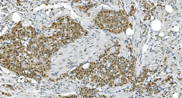 a09236 1 lsm7 primary antibodies ihc testing 13