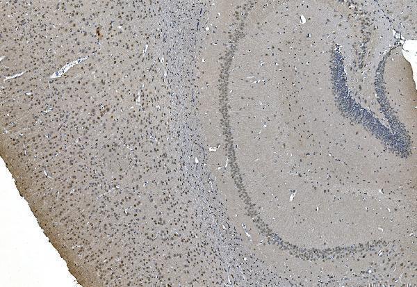 a09236 1 lsm7 primary antibodies ihc testing 4