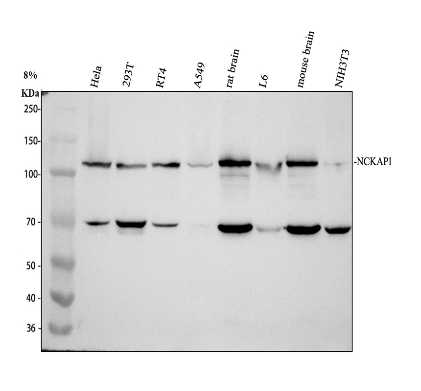 Western blot analysis of NCKAP1 using anti-NCKAP1 antibody (A09238-1)