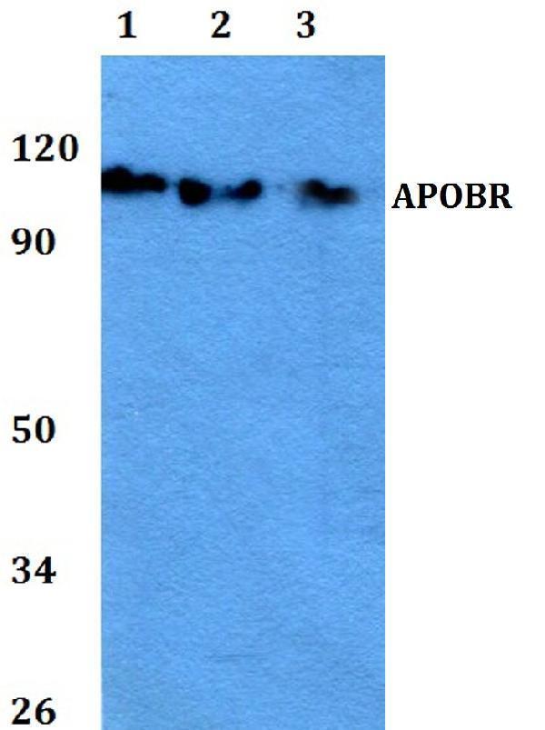 Western blot (WB) analysis of APOBR polyclonal antibody at 1:500 dilution
Lane1:A549 whole cell lysate
Lane2:MCF-7 whole cell lysate 
Lane3:PC12 whole cell lysate 
