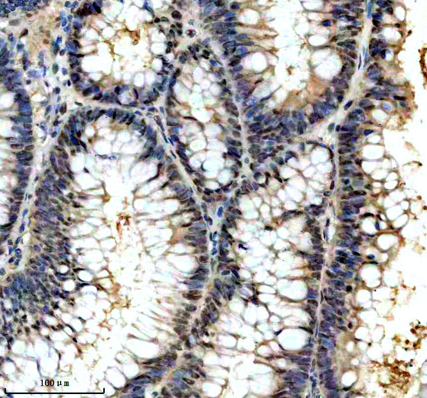 IHC analysis of NUDT21 using anti-NUDT21 antibody (A09247-1)