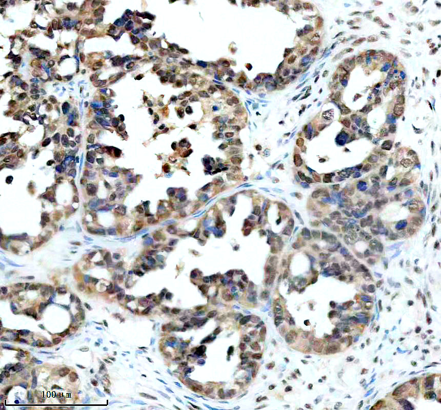 IHC analysis of NUDT21 using anti-NUDT21 antibody (A09247-1)