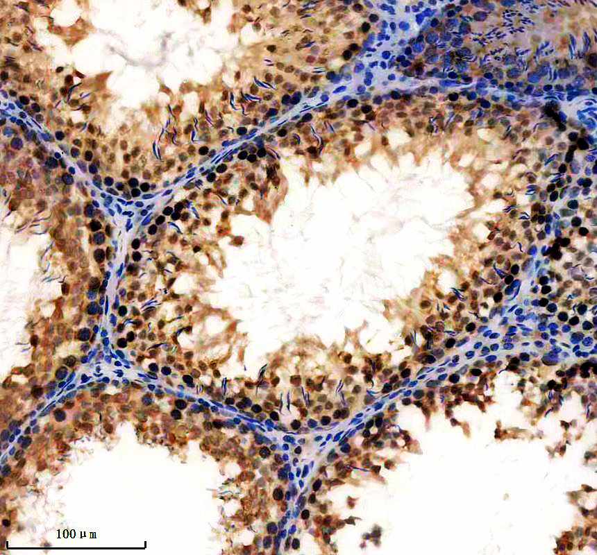 a09247 1 nudt21 primary antibodies ihc testing 3