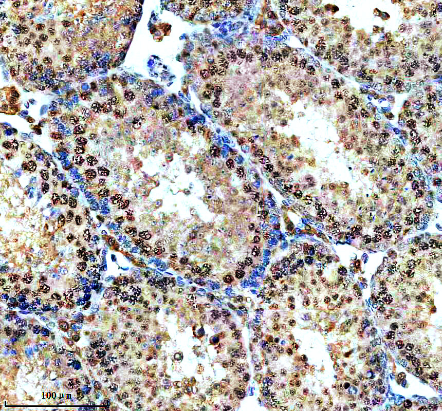a09247 1 nudt21 primary antibodies ihc testing 4