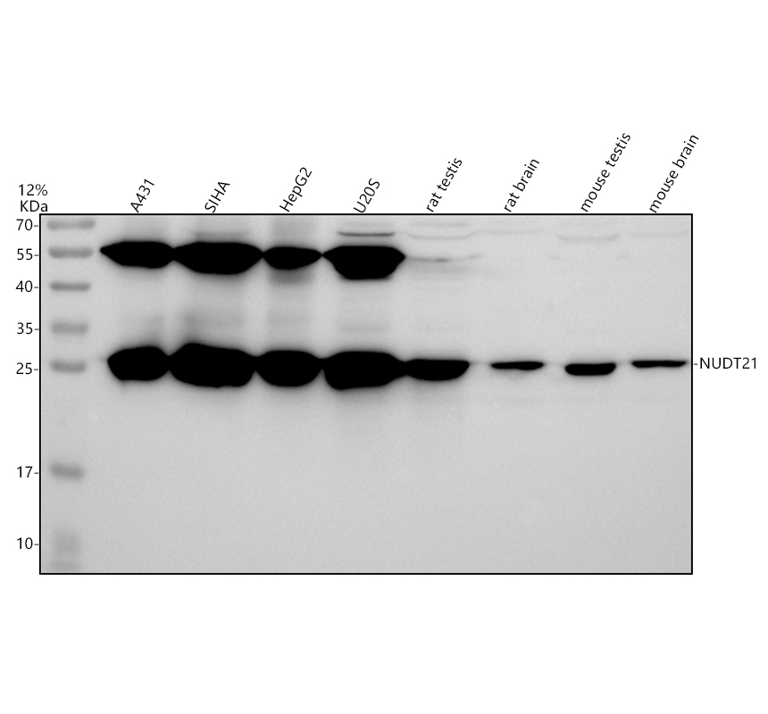 Western blot analysis of NUDT21 using anti-NUDT21 antibody (A09247-1)