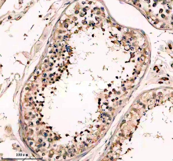 IHC analysis of DDX25 using anti-DDX25 antibody (A09248-1)