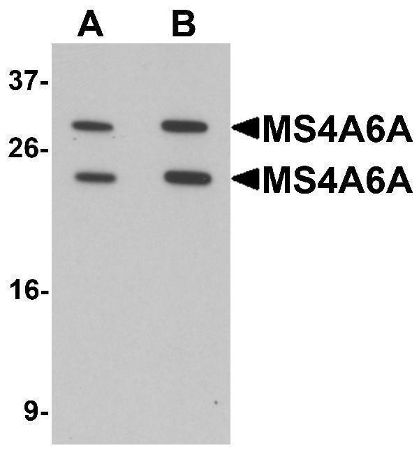 a09251 ms4a6a primary antibodies wb testing 1
