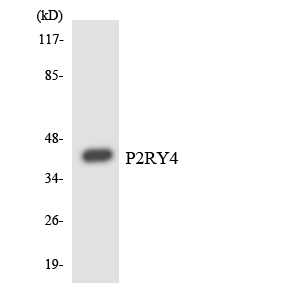 Western blot analysis of the lysates from COLO205 cells using P2RY4 antibody
