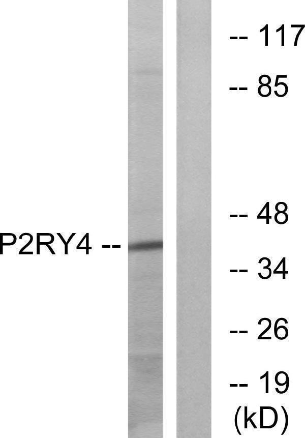 Western blot analysis of lysates from HeLa cells, using P2RY4 Antibody