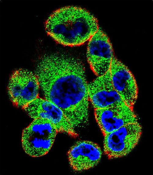 Confocal immunofluorescent analysis of SOCS4 Antibody (Center) with A2058 cell followed by Alexa Fluor 488-conjugated goat anti-rabbit lgG (green)