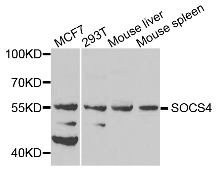 Western blot analysis of extracts of various cells, using SOCS4 antibody