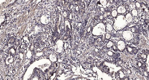 a09262 1 riok3 primary antibodies ihc testing 1