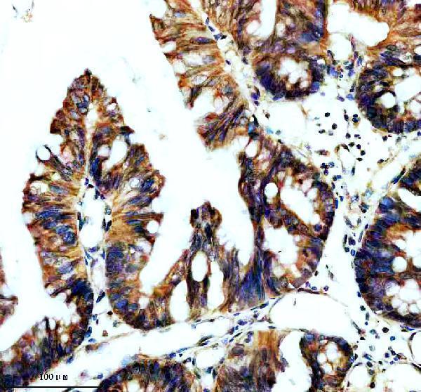 IHC analysis of TBC1D5 using anti-TBC1D5 antibody (A09263)