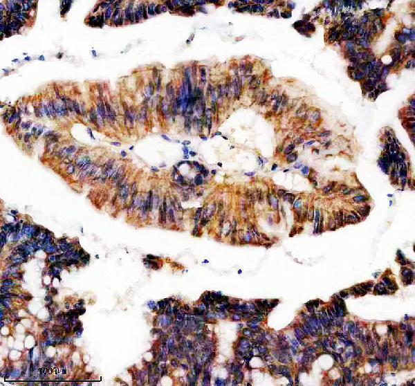 IHC analysis of TBC1D5 using anti-TBC1D5 antibody (A09263)