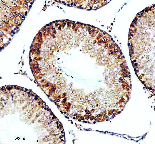 IHC analysis of TBC1D5 using anti-TBC1D5 antibody (A09263)