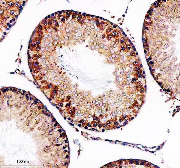 a09263 tbc1d5 primary antibodies ihc testing 4