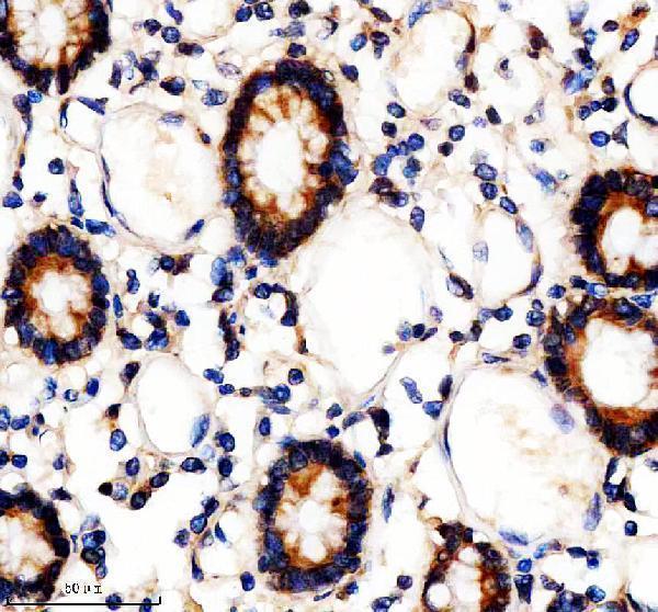 a09263 tbc1d5 primary antibodies ihc testing 5