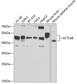 a09264 actl6b primary antiboties wb testing 1