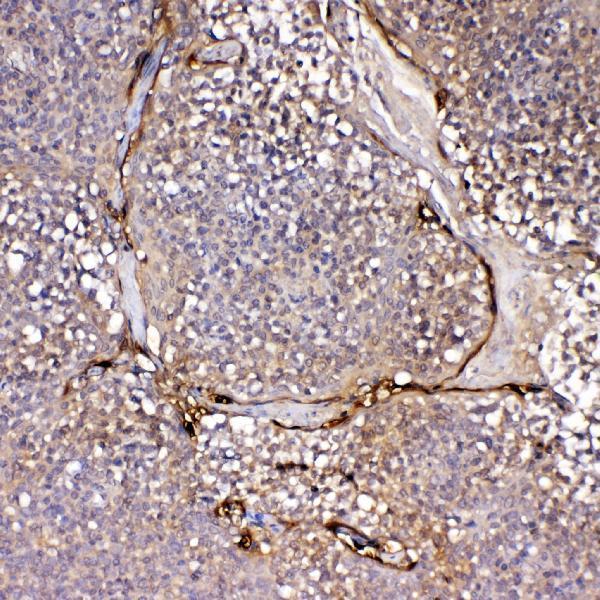  IHC analysis of IL1F10 using anti-IL1F10 antibody (A09268-1)