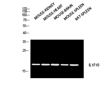 Western blot analysis of MOUSE-KIDNEY MOUSE-HEART MOUSE-BRAIN MOUSE-SPLEEN RAT-SPLEEN using IL1F10 antibody