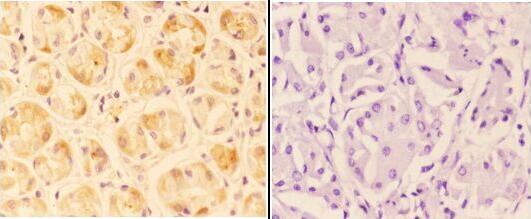 a09270 angptl1 primary antiboties ihc testing 2